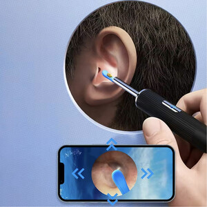 نمای باز گوش پاک کن هوشمند F213D