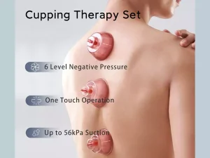 ست بادکش برقی هوشمند یوپین شیائومی ZDEER Smart Cupping Therapy Massager ZD-G0201