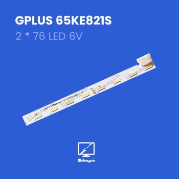 بک لایت اورجینال 65KE821S جی پلاس