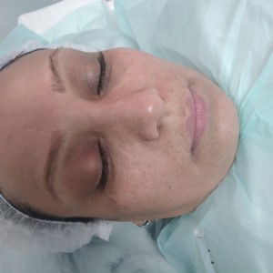 دوره مبتدی پاکسازی پوست صورت