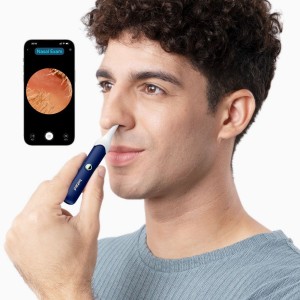 گوش پاک کن هوشمند شیائومی  Xiaomi  Bebird R1 در بروزکالا