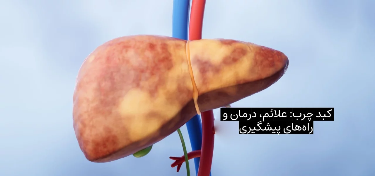 کبد چرب علائم، درمان و راه‌های پیشگیری