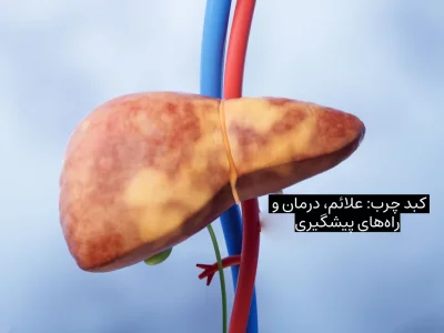 کبد چرب علائم، درمان و راه‌های پیشگیری