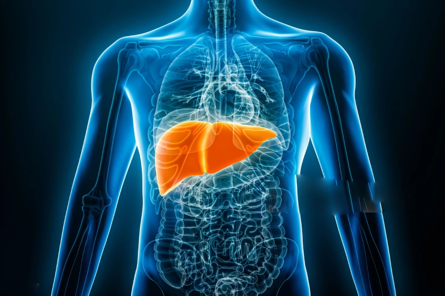کبد چرب