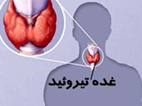 آزمایش تیروئید و هورمونهای تیروئیدی