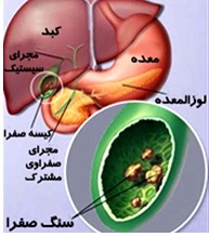 کیسه صفرا چیست و در بدن ما چه می کند؟ قسمت آخر