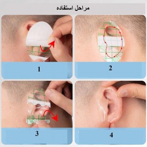 چسب گوش نوزاد ضد آب