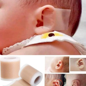 چسب فرم دهی و اصلاح گوش نوزاد