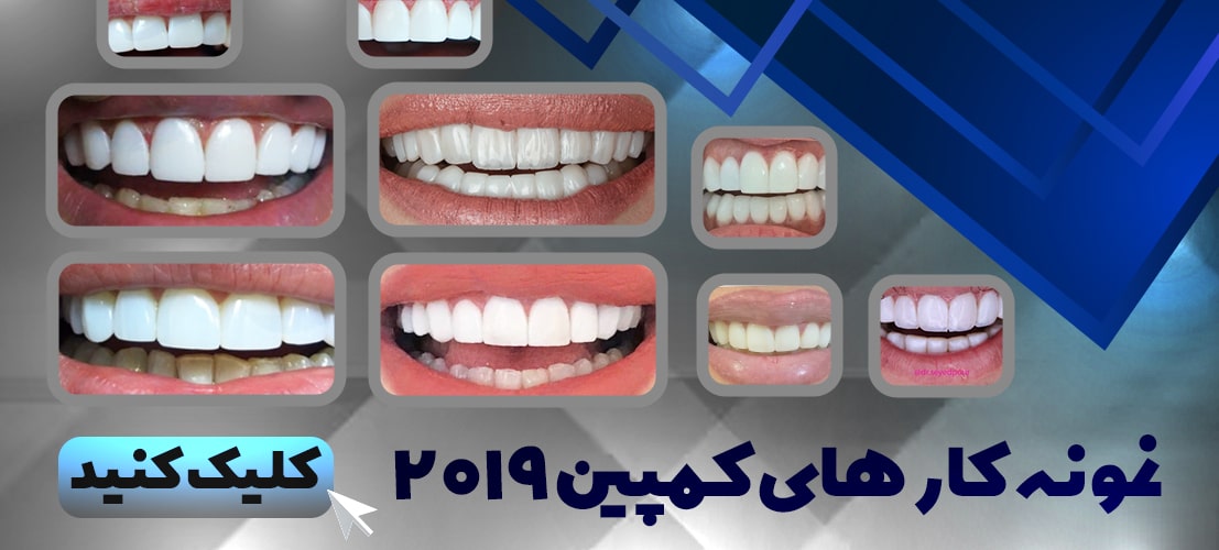 نمونه کارهای کمپین 2019