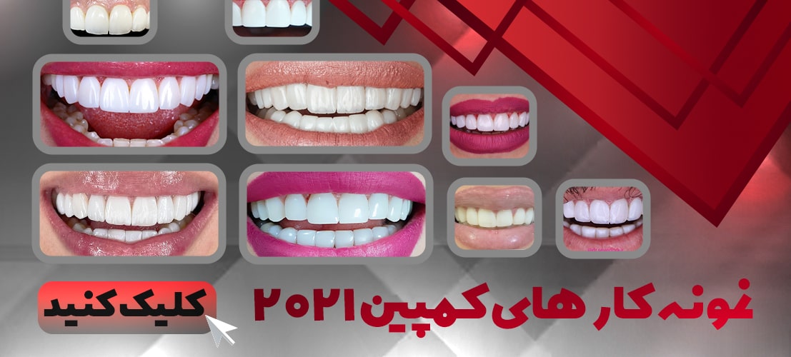 نمونه کار های کمپین 2021