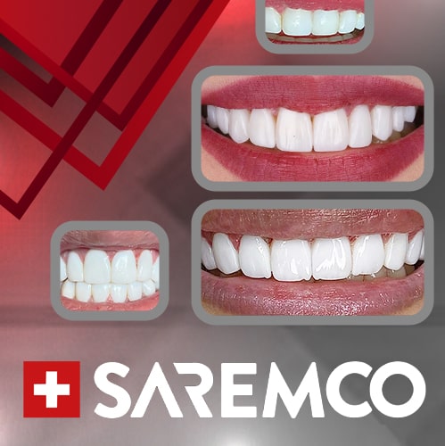 نمونه کار های کمپین 2021