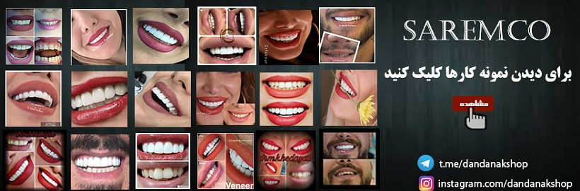 نمونه کار دندانپزشکان گرامی با کامپوزیت های سارمکو