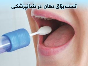 تست بزاق دهان در دندانپزشکی