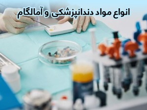 انواع مواد دندانپزشکی و بررسی آمالگام دندانپزشکی