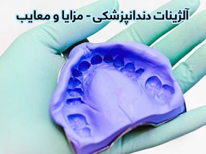 آلژینات دندانپزشکی - مزایا و معایب