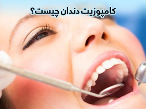 کامپوزیت دندان؛ ناگفته ها، عوارض و مزایا