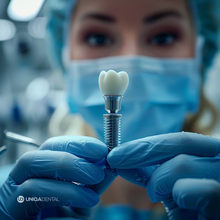 ایمپلنت دندان پوسیده در اصفهان