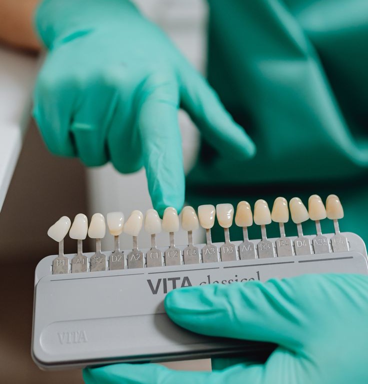 تأثیر ضدعفونی کننده ها بر راهنمای رنگ دندان در اصفهان