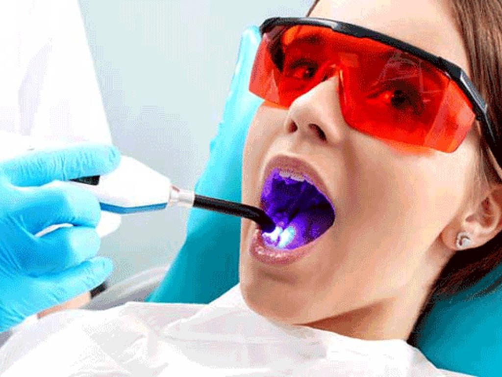 هزینه عصب کشی دندان 2025-1404 در اصفهان