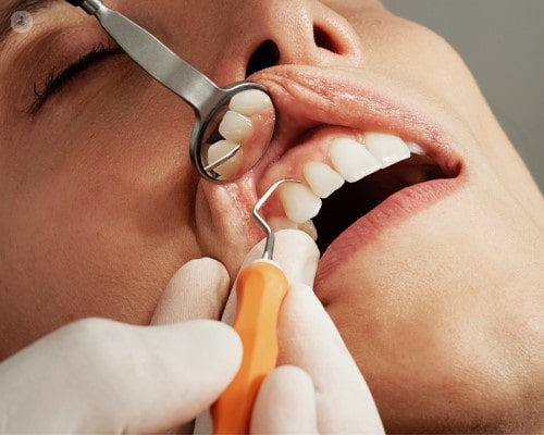 متخصص و دکتر آبسه دندان در اصفهان