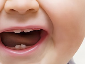 مراقبت از دندان نوزاد در اصفهان