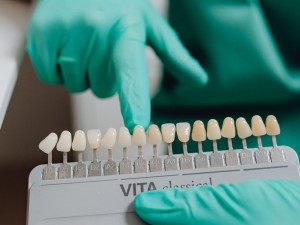 تأثیر ضدعفونی کننده ها بر راهنمای رنگ دندان در اصفهان