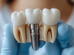 اوردنچر در اصفهان چیست