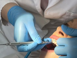 روکش دندان در نطنز