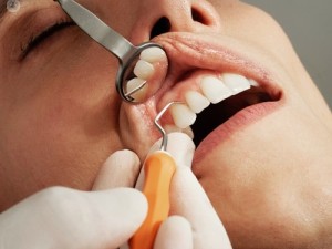 متخصص و دکتر آبسه دندان در فولادشهر زرین شهر اصفهان