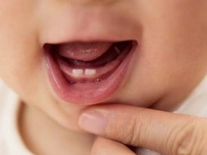 آموزش مراقبت از دندان نوزاد 13 (سیزده) ماهه