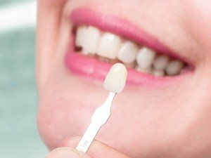 تأثیر ضدعفونی کننده ها بر راهنمای رنگ دندان