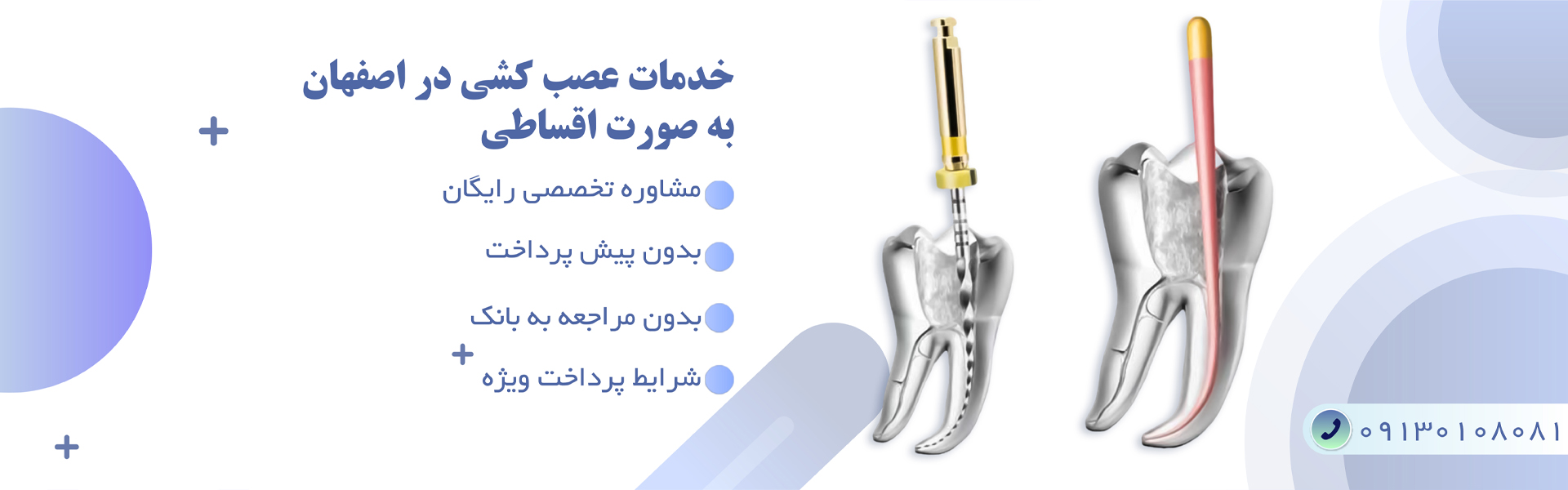 عصب کشی در اصفهان