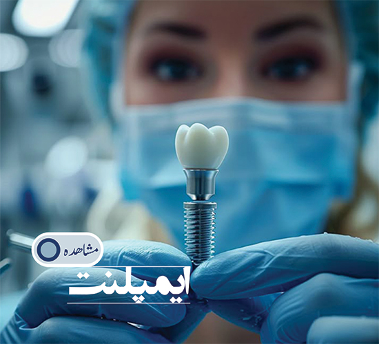 ایمپلنت دندان