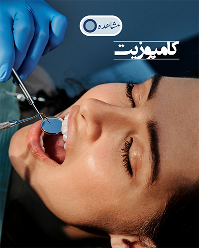 کتمپوزیت دندان