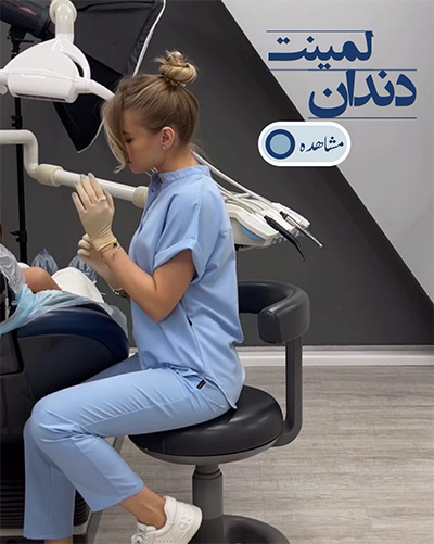 لمینت دندان