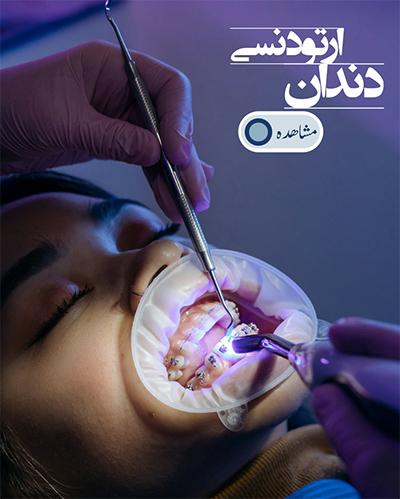 ارتودنسی دندان