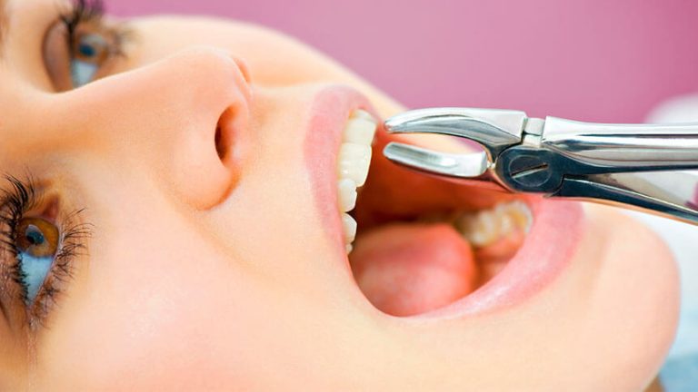 مطب و کلینیک کشیدن دندان در اصفهان - کلینیک دندانپزشکی اصفهان