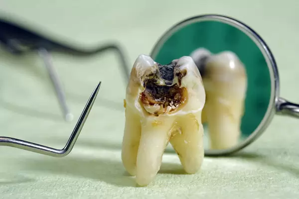 متخصص ریشه دندان در اصفهان - کلینیک دندانپزشکی اصفهان