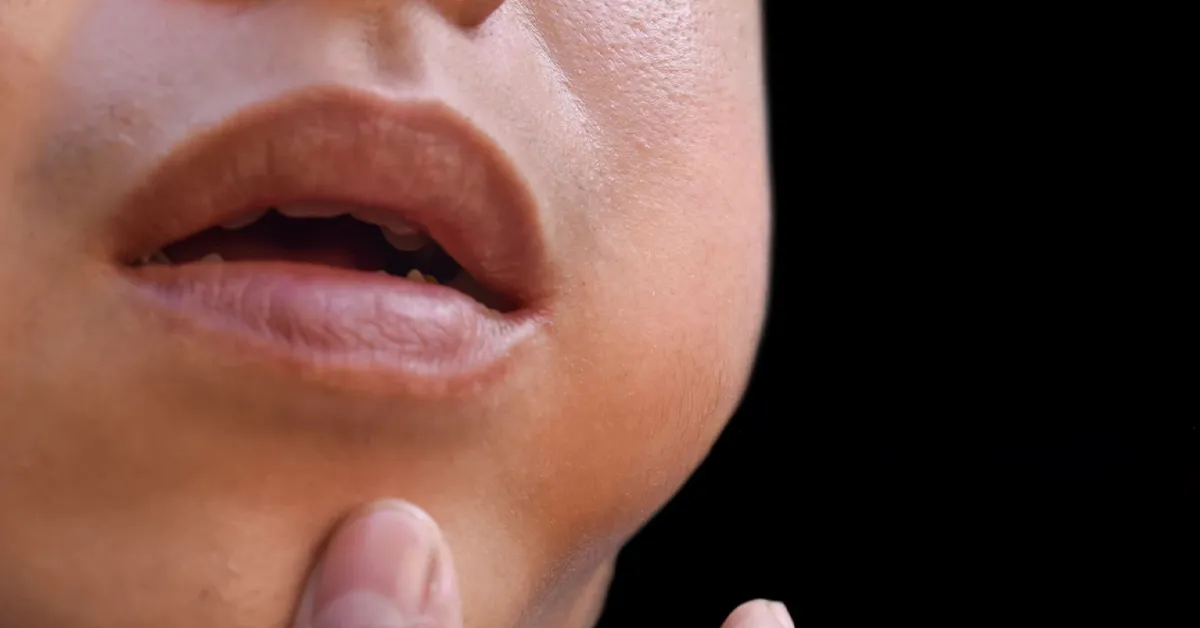 متخصص و دکتر آبسه دندان در اصفهان - کلینیک دندانپزشکی اصفهان