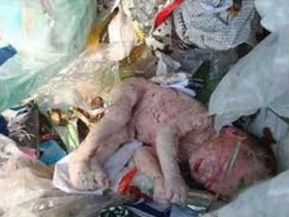 سقط جنین؛ پدیده ای که مثل قارچ تکثیر شده است