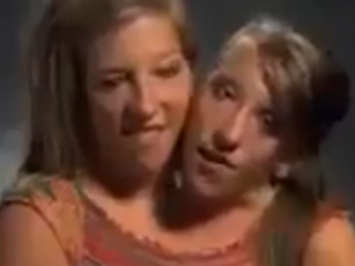 ویدئو :  زندگی کردن وغذا خوردن کسیکه دوسرداردو یک بدن واقعادیدنی