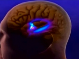 ویدئو :  نواحی مختلف مغزی و کارکردآنها