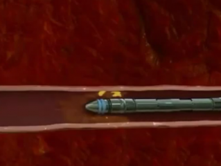 ویدئو :  خداحافظی با سکته قلبی