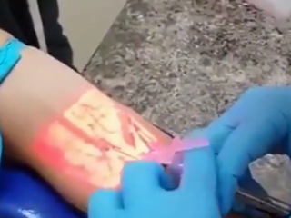 ویدئو  :   شیوه پیدا کردن رگ در آمریکا رو ببینید