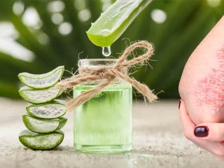 کاهش علائم پسوریازیس با یک گیاه دارویی