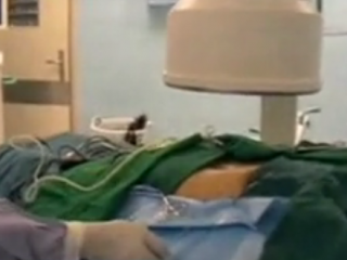 ویدئو :   فیلم جراحی کلیه به روش آندوسکوپی توسط دکتر حسین کرمی