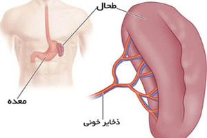 چرا طحال بزرگ میشود؟ + عوارض و علائم