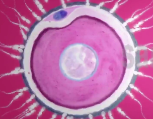 ویدئو :   اگر در اطرافیانتان کسی نازایی دارددیدن این ویدیو ضروریست