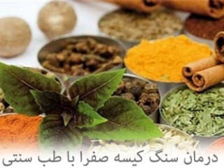 راه حل های طب سنتی برای دفع سنگ کیسه صفرا
