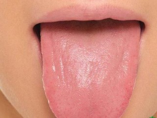 10 علت شایع گزگز نوک زبان